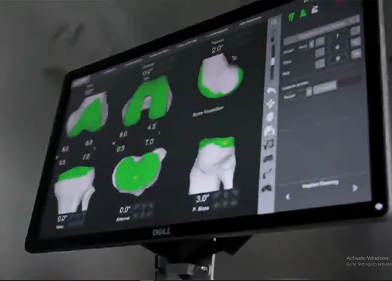LEO2 by Stryker Mako visual panel while surgery