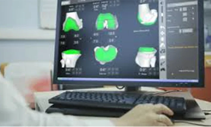 Pre-Planning and Segmentation of the CT SCAN image Robotic Knee Replacement Surgery
